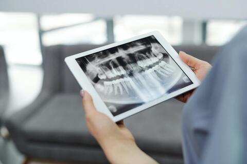 affordable tooth implant procedure windsor